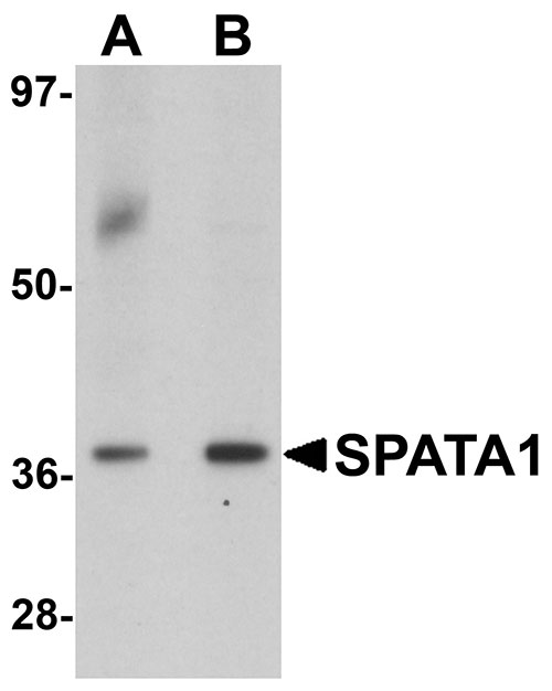 1 - SPATA1 Antibody ASC11393