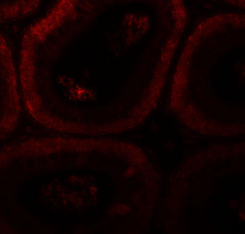 3 - SPATA3 Antibody ASC11394