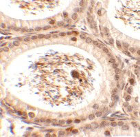 2 - SPATA3 Antibody ASC11394