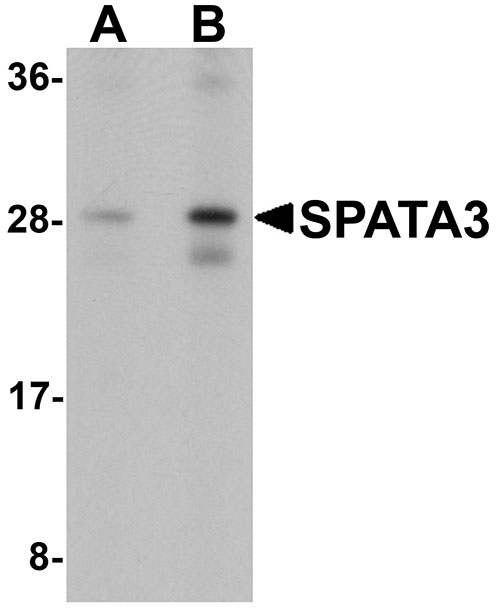 1 - SPATA3 Antibody ASC11394