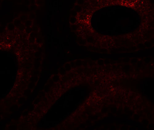 3 - SPATA6 Antibody ASC11396