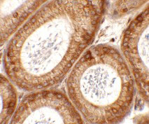 2 - SPATA6 Antibody ASC11396