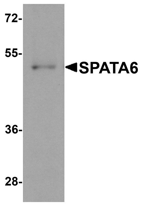 1 - SPATA6 Antibody ASC11396