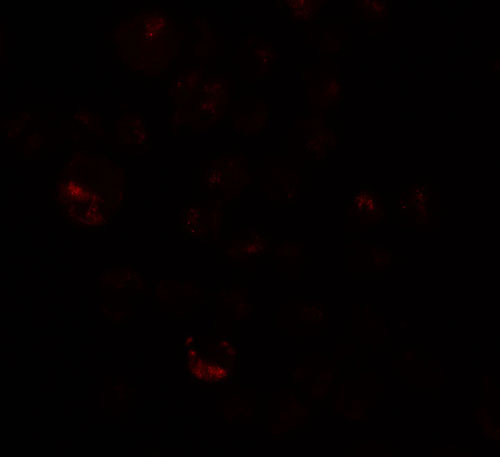 3 - PRICKLE4 Antibody ASC11401