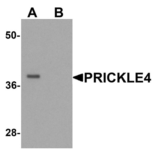 1 - PRICKLE4 Antibody ASC11401