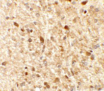 2 - MS4A6A Antibody ASC11403