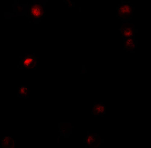 3 - Thymopoietin Antibody ASC11407