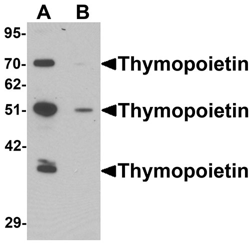 1 - Thymopoietin Antibody ASC11407