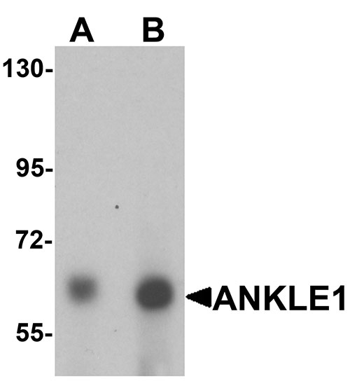 1 - ANKLE1 Antibody ASC11408