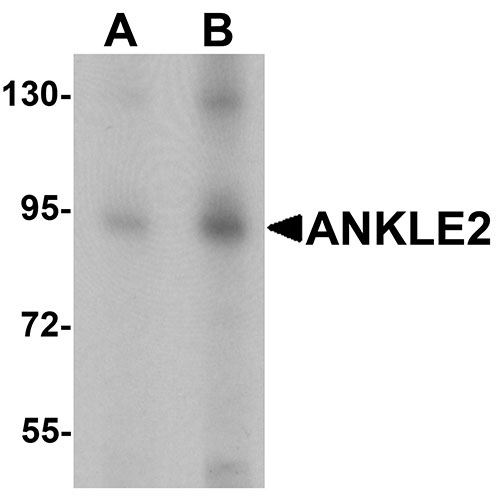 1 - ANKLE2 Antibody ASC11409