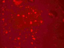 3 - ZGPAT Antibody ASC11410