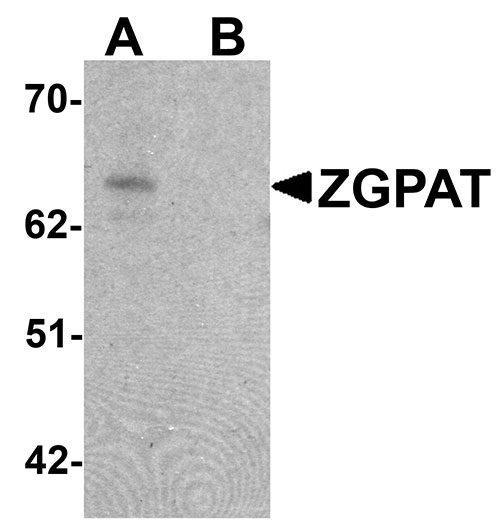 1 - ZGPAT Antibody ASC11410