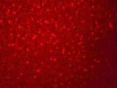 3 - SIVA Antibody ASC11414