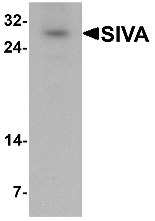 1 - SIVA Antibody ASC11414