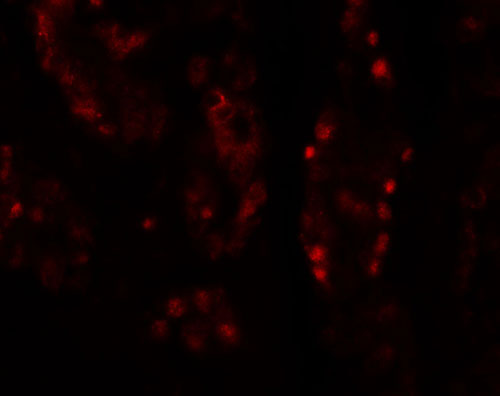 3 - DISP1 Antibody ASC11417