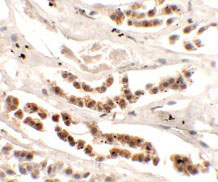 2 - DISP1 Antibody ASC11417