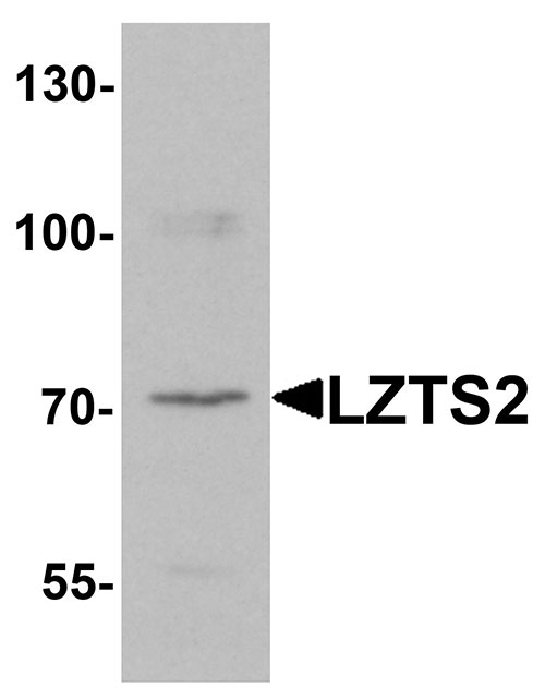 1 - LZTS2 Antibody ASC11420