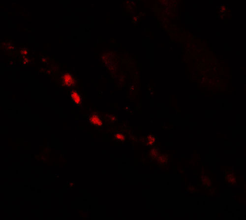 3 - PTCHD2 Antibody ASC11421