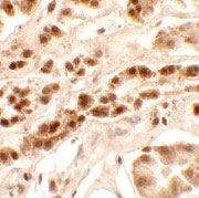 2 - PTCHD2 Antibody ASC11421