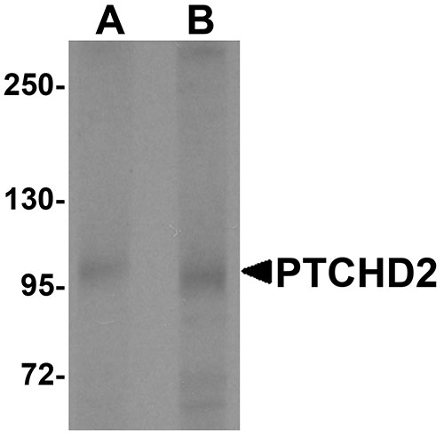 1 - PTCHD2 Antibody ASC11421