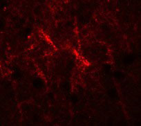 3 - SIPA1 Antibody ASC11423