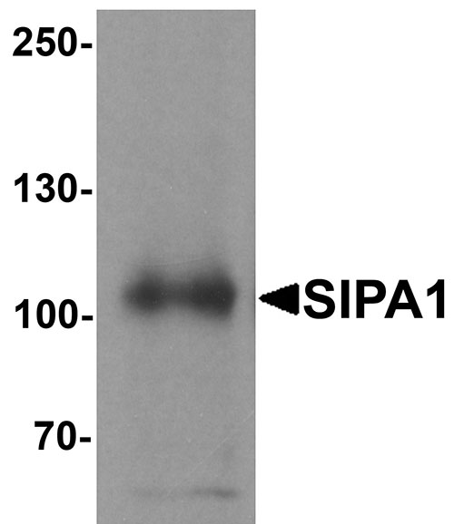1 - SIPA1 Antibody ASC11423