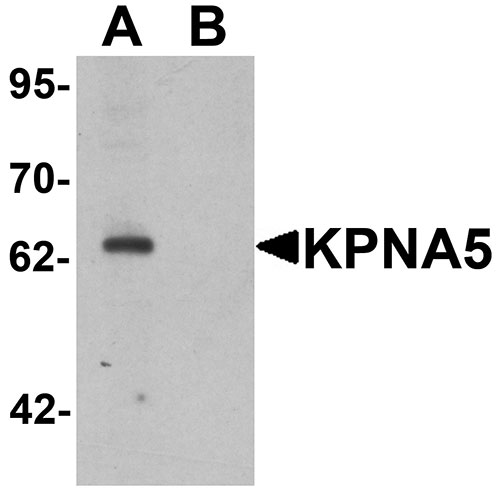 1 - KPNA5 Antibody ASC11428