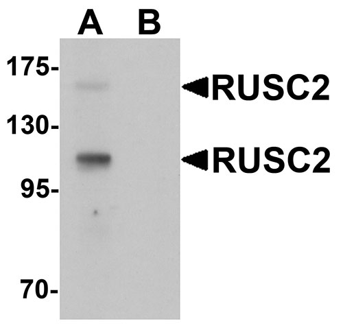 1 - RUSC2 Antibody ASC11430