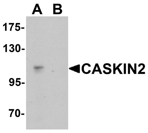 1 - CASKIN2 Antibody ASC11431