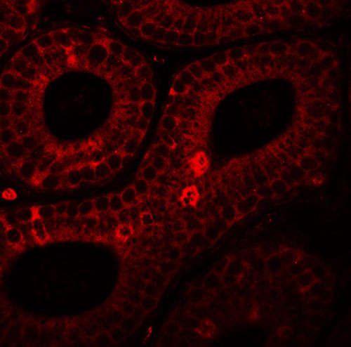 3 - SPINK2 Antibody ASC11432