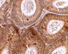 2 - SPINK2 Antibody ASC11432