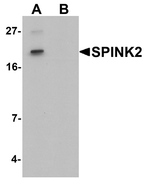 1 - SPINK2 Antibody ASC11432