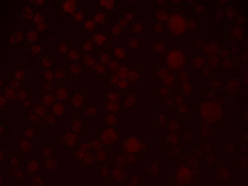 3 - SLAIN1 Antibody ASC11433