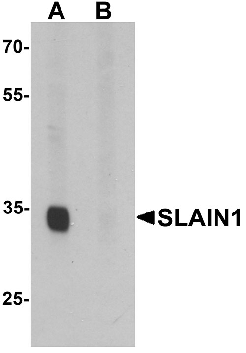1 - SLAIN1 Antibody ASC11433