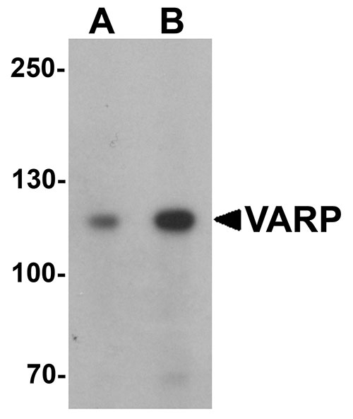 1 - VARP Antibody ASC11434