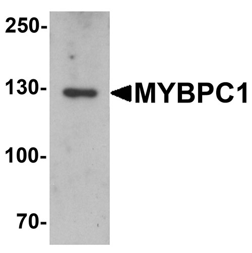 1 - MYBPC1 Antibody ASC11435