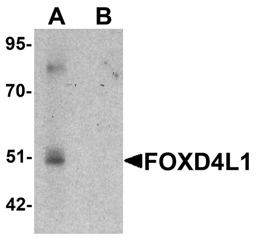 1 - FOXD4L1 Antibody ASC11437