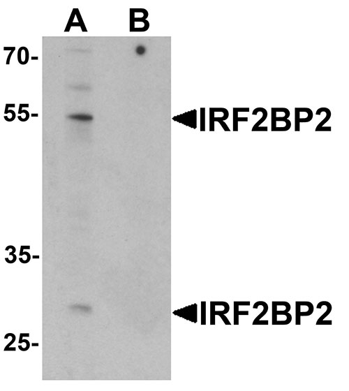 1 - IRF2BP2 Antibody ASC11438