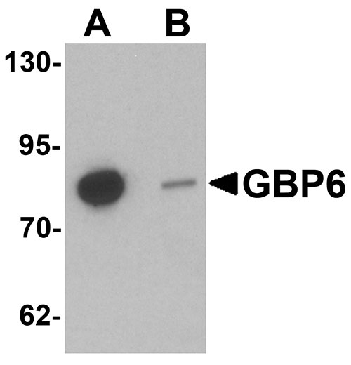 1 - GBP6 Antibody ASC11439