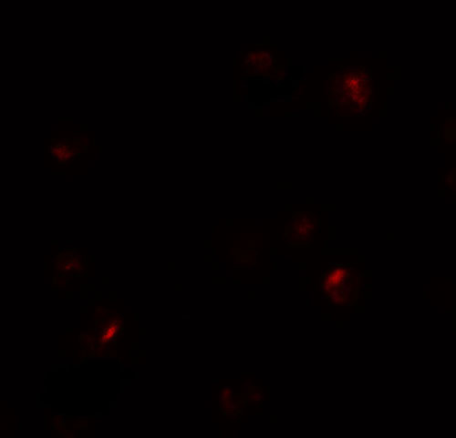 3 - B9D1 Antibody ASC11440