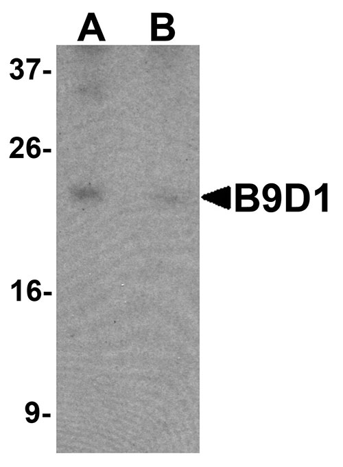 1 - B9D1 Antibody ASC11440