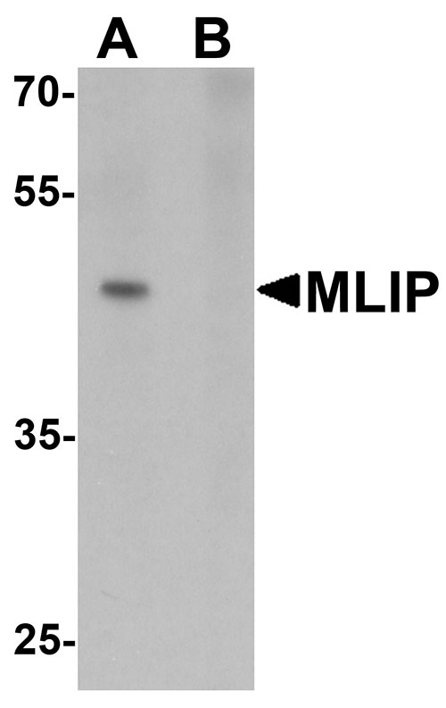 1 - MLIP Antibody ASC11441