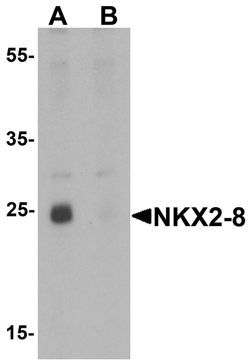 1 - NKX2-8 Antibody ASC11449