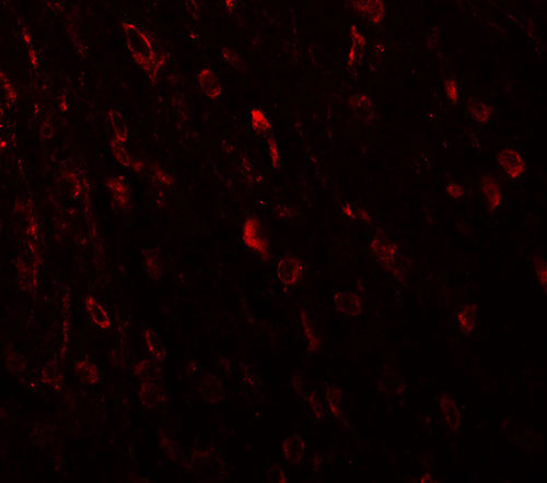 3 - TSHZ3 Antibody ASC11452