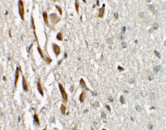 2 - TSHZ3 Antibody ASC11452