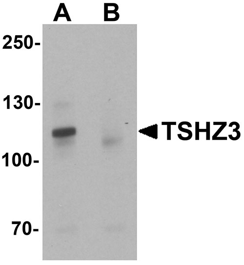 1 - TSHZ3 Antibody ASC11452