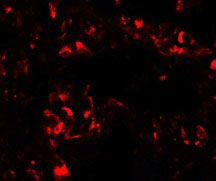 3 - FOXRED2 Antibody ASC11453