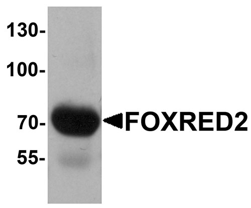 1 - FOXRED2 Antibody ASC11453