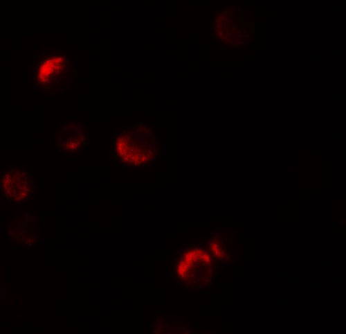 3 - YPEL1 Antibody ASC11456