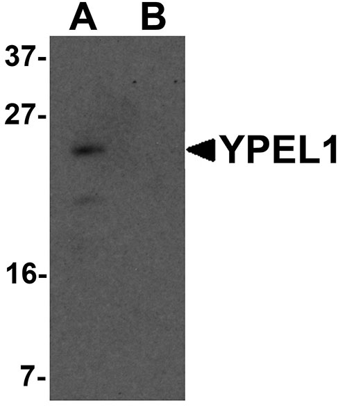 1 - YPEL1 Antibody ASC11456